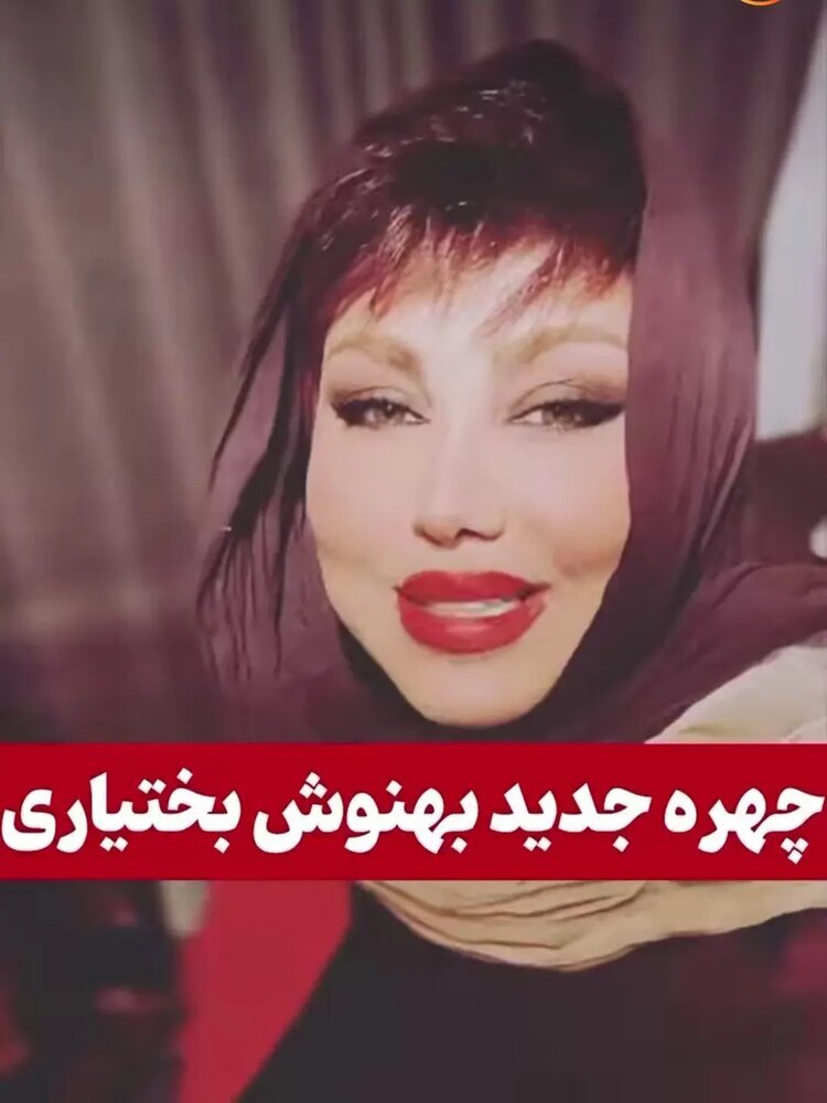 عکس چهره جدید بهنوش بختیاری پس از عمل زیبایی
