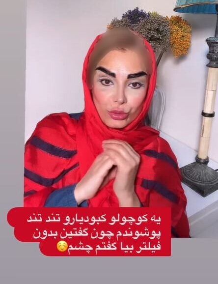 تغییر چهره صبا راد با این عمل زیبایی/عکس تغییر چهره صبا راد با این عمل زیبایی/عکس