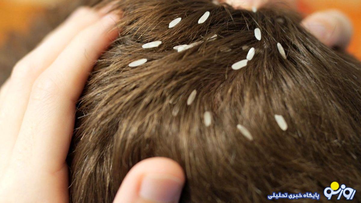 شپش به جان مدارس افتاد شپش به جان مدارس افتاد